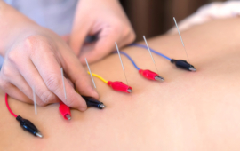 Electroacupuncture - Services - KatieKim Acupuncture & Herb Clinic